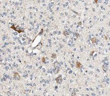 ALDOC / Aldolase C Antibody - 1:100 staining human brain tissue by IHC-P. The tissue was formaldehyde fixed and a heat mediated antigen retrieval step in citrate buffer was performed. The tissue was then blocked and incubated with the antibody for 1.5 hours at 22°C. An HRP conjugated goat anti-rabbit antibody was used as the secondary.