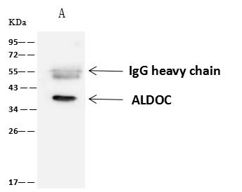 ALDOC / Aldolase C Antibody - ALDOC was immunoprecipitated using: Lane A: 0.5 mg Jurkat Whole Cell Lysate. 4 uL anti-ALDOC rabbit polyclonal antibody and 60 ug of Immunomagnetic beads Protein A/G. Primary antibody: Anti-ALDOC rabbit polyclonal antibody, at 1:100 dilution. Secondary antibody: Goat Anti-Rabbit IgG (H+L)/HRP at 1/10000 dilution. Developed using the ECL technique. Performed under reducing conditions. Predicted band size: 39 kDa. Observed band size: 39 kDa.