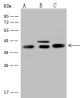 ALDOC / Aldolase C Antibody - Anti-ALDOC rabbit polyclonal antibody at 1:500 dilution. Lane A: U87-MG Whole Cell Lysate. Lane B: MCF-7 Whole Cell Lysate. Lane C: Jurkat Whole Cell Lysate. Lysates/proteins at 30 ug per lane. Secondary: Goat Anti-Rabbit IgG (H+L)/HRP at 1/10000 dilution. Developed using the ECL technique. Performed under reducing conditions. Predicted band size: 39 kDa. Observed band size: 39 kDa.