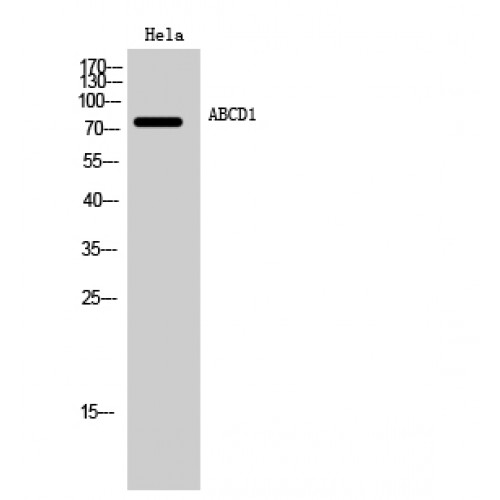 ALDP / ABCD1 Antibody - Western blot of ABCD1 antibody