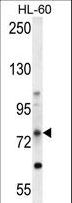 ALDP / ABCD1 Antibody - ABCD1 Antibody western blot of HL-60 cell line lysates (35 ug/lane). The ABCD1 antibody detected the ABCD1 protein (arrow).