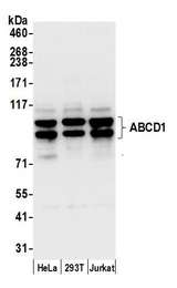 ALDP / ABCD1 Antibody - Detection of human ABCD1 by western blot. Samples: Whole cell lysate (15 µg) from HeLa, HEK293T, and Jurkat cells prepared using NETN lysis buffer. Antibody: Affinity purified rabbit anti-ABCD1 antibody used for WB at 0.1 µg/ml. Detection: Chemiluminescence with an exposure time of 3 seconds.