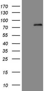 ALDP / ABCD1 Antibody - HEK293T cells were transfected with the pCMV6-ENTRY control. (Left lane) or pCMV6-ENTRY ABCD1. (Right lane) cDNA for 48 hrs and lysed