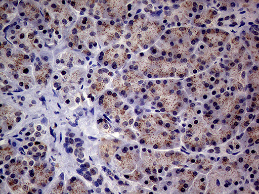 ALDP / ABCD1 Antibody - Immunohistochemical staining of paraffin-embedded Human pancreas tissue within the normal limits using anti-ABCD1 mouse monoclonal antibody. (Heat-induced epitope retrieval by 1mM EDTA in 10mM Tris buffer. (pH8.5) at 120°C for 3 min. (1:250)
