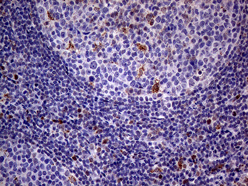 ALDP / ABCD1 Antibody - Immunohistochemical staining of paraffin-embedded Human lymph node tissue within the normal limits using anti-ABCD1 mouse monoclonal antibody. (Heat-induced epitope retrieval by 1mM EDTA in 10mM Tris buffer. (pH8.5) at 120°C for 3 min. (1:250)