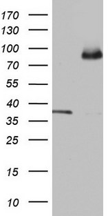 ALDP / ABCD1 Antibody - HEK293T cells were transfected with the pCMV6-ENTRY control (Left lane) or pCMV6-ENTRY ABCD1 (Right lane) cDNA for 48 hrs and lysed. Equivalent amounts of cell lysates (5 ug per lane) were separated by SDS-PAGE and immunoblotted with anti-ABCD1.