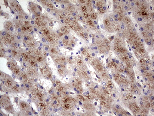 ALDP / ABCD1 Antibody - IHC of paraffin-embedded Human liver tissue using anti-ABCD1 mouse monoclonal antibody. (Heat-induced epitope retrieval by 1 mM EDTA in 10mM Tris, pH8.5, 120°C for 3min).