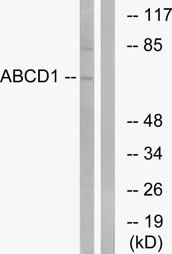 ALDP / ABCD1 Antibody - Western blot analysis of lysates from Jurkat cells, using ABCD1 Antibody. The lane on the right is blocked with the synthesized peptide.