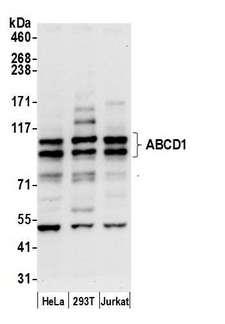 ALDP / ABCD1 Antibody - Detection of human ABCD1 by western blot. Samples: Whole cell lysate (15 µg) from HeLa, HEK293T, and Jurkat cells prepared using NETN lysis buffer. Antibody: Affinity purified rabbit anti-ABCD1 antibody used for WB at 0.1 µg/ml. Detection: Chemiluminescence with an exposure time of 10 seconds.