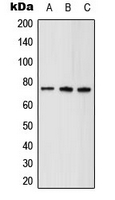 ALDP / ABCD1 Antibody - Western blot analysis of ABCD1 expression in HeLa (A); mouse brain (B); rat kidney (C) whole cell lysates.
