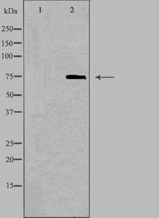 ALDP / ABCD1 Antibody - Western blot analysis of extracts of Jurkat cells using ABCD1 antibody. The lane on the left is treated with the antigen-specific peptide.