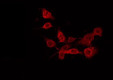 ALDP / ABCD1 Antibody - Staining HeLa cells by IF/ICC. The samples were fixed with PFA and permeabilized in 0.1% Triton X-100, then blocked in 10% serum for 45 min at 25°C. The primary antibody was diluted at 1:200 and incubated with the sample for 1 hour at 37°C. An Alexa Fluor 594 conjugated goat anti-rabbit IgG (H+L) Ab, diluted at 1/600, was used as the secondary antibody.