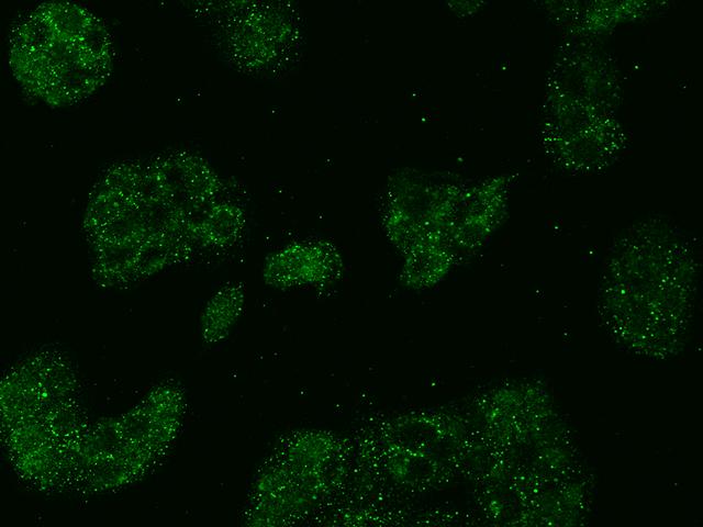 ALDP / ABCD1 Antibody - Immunofluorescence staining of ABCD1 in MCF7 cells. Cells were fixed with 4% PFA, permeabilzed with 0.1% Triton X-100 in PBS, blocked with 10% serum, and incubated with rabbit anti-Human ABCD1 polyclonal antibody (dilution ratio 1:500) at 4°C overnight. Then cells were stained with the Alexa Fluor 488-conjugated Goat Anti-rabbit IgG secondary antibody (green). Positive staining was localized to Cytoplasm.