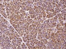ALDP / ABCD1 Antibody - Immunochemical staining of human ABCD1 in human pancreas with rabbit polyclonal antibody at 1:300 dilution, formalin-fixed paraffin embedded sections.