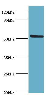 ALG1 Antibody - Western blot. All lanes: ALG1 antibody at 10 ug/ml+HeLa whole cell lysate. Secondary antibody: Goat polyclonal to rabbit at 1:10000 dilution. Predicted band size: 53 kDa. Observed band size: 53 kDa Immunohistochemistry.
