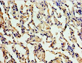 ALG1 Antibody - Immunohistochemistry of paraffin-embedded human lung tissue using antibody at 1:100 dilution.