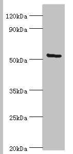 ALG1 Antibody - Western blot All lanes: ALG1 antibody at 10µg/ml + Hela whole cell lysate Secondary Goat polyclonal to rabbit IgG at 1/10000 dilution Predicted band size: 53, 41 kDa Observed band size: 53 kDa
