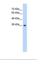 ALG1 Antibody - Jurkat cell lysate. Antibody concentration: 2.5 ug/ml. Gel concentration: 12%.  This image was taken for the unconjugated form of this product. Other forms have not been tested.