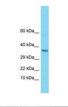 ALG1 Antibody - Western blot of Human Uterus Tumor. ALG1 antibody dilution 1.0 ug/ml.  This image was taken for the unconjugated form of this product. Other forms have not been tested.