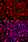 ALG1 Antibody - Immunofluorescence analysis of A549 cells.