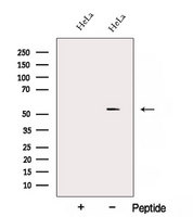 ALG1 Antibody - Western blot analysis of extracts of HeLa cells using ALG1 antibody. The lane on the left was treated with blocking peptide.