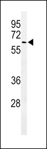 ALG10 / KCR1 Antibody - Western blot of ALG10 Antibody in A375 cell line lysates (35 ug/lane). ALG10 (arrow) was detected using the purified antibody.