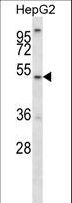 ALG11 Antibody - ALG11 Antibody western blot of HepG2 cell line lysates (35 ug/lane). The ALG11 antibody detected the ALG11 protein (arrow).