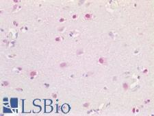 ALG11 Antibody - Human Brain, Cortex: Formalin-Fixed, Paraffin-Embedded (FFPE)
