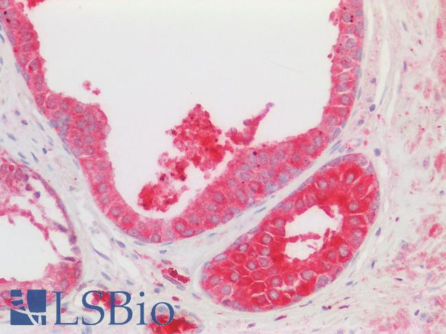 ALG11 Antibody - Human Prostate, Glands: Formalin-Fixed, Paraffin-Embedded (FFPE)