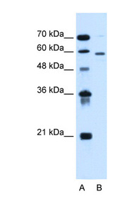 ALG11 Antibody - ALG11 antibody ARP44463_P050-NP_001004127-ALG11(asparagine-linked glycosylation 11 homolog ) Antibody Western blot of HepG2 cell lysate.  This image was taken for the unconjugated form of this product. Other forms have not been tested.