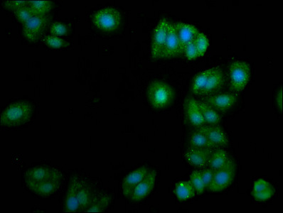 ALG11 Antibody - Immunofluorescence staining of HepG2 cells at a dilution of 1:105, counter-stained with DAPI. The cells were fixed in 4% formaldehyde, permeabilized using 0.2% Triton X-100 and blocked in 10% normal Goat Serum. The cells were then incubated with the antibody overnight at 4 °C.The secondary antibody was Alexa Fluor 488-congugated AffiniPure Goat Anti-Rabbit IgG (H+L) .