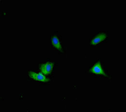 ALG12 Antibody - Immunofluorescent analysis of Hela cells using ALG12 Antibody at dilution of 1:100 and Alexa Fluor 488-congugated AffiniPure Goat Anti-Rabbit IgG(H+L)