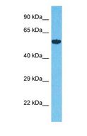 ALG12 Antibody - Western blot of ALG12 Antibody with human 293T Whole Cell lysate.  This image was taken for the unconjugated form of this product. Other forms have not been tested.
