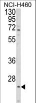 ALG14 Antibody - Western blot of ALG14 Antibody in NCI-H460 cell line lysates (35 ug/lane). ALG14 (arrow) was detected using the purified antibody.