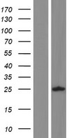 ALG1L Protein - Western validation with an anti-DDK antibody * L: Control HEK293 lysate R: Over-expression lysate
