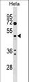 ALG2 Antibody - ALG2 Antibody western blot of HeLa cell line lysates (35 ug/lane). The ALG2 antibody detected the ALG2 protein (arrow).