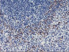 ALG2 Antibody - IHC of paraffin-embedded Human tonsil using anti-ALG2 mouse monoclonal antibody. (Heat-induced epitope retrieval by 10mM citric buffer, pH6.0, 100C for 10min).