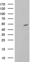 ALG2 Antibody - HEK293T cells were transfected with the pCMV6-ENTRY control (Left lane) or pCMV6-ENTRY ALG2 (Right lane) cDNA for 48 hrs and lysed. Equivalent amounts of cell lysates (5 ug per lane) were separated by SDS-PAGE and immunoblotted with anti-ALG2.
