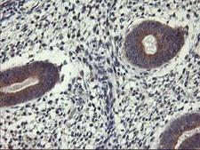 ALG2 Antibody - IHC of paraffin-embedded Human endometrium tissue using anti-ALG2 mouse monoclonal antibody.