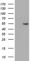 ALG2 Antibody - HEK293T cells were transfected with the pCMV6-ENTRY control (Left lane) or pCMV6-ENTRY ALG2 (Right lane) cDNA for 48 hrs and lysed. Equivalent amounts of cell lysates (5 ug per lane) were separated by SDS-PAGE and immunoblotted with anti-ALG2.