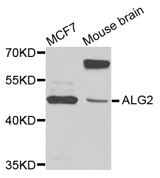 ALG2 Antibody - Western blot analysis of extracts of various cells.