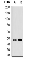 ALG2 Antibody - Western blot analysis of ALG2 expression in MCF7 (A); mouse brain (B) whole cell lysates.