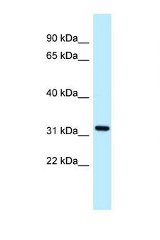 ALG5 Antibody - ALG5 antibody Western blot of 1 Cell lysate. Antibody concentration 1 ug/ml.  This image was taken for the unconjugated form of this product. Other forms have not been tested.