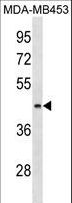 ALG8 Antibody - ALG8 Antibody western blot of MDA-MB453 cell line lysates (35 ug/lane). The ALG8 antibody detected the ALG8 protein (arrow).