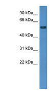 ALG8 Antibody - ALG8 antibody Western blot of Rat Heart lysate. This image was taken for the unconjugated form of this product. Other forms have not been tested.