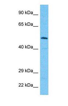ALG9 Antibody - Western blot of ALG9 Antibody with human Jurkat Whole Cell lysate.  This image was taken for the unconjugated form of this product. Other forms have not been tested.