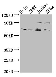 ALG9 Antibody - Positive Western Blot detected in Hela whole cell lysate, 293T whole cell lysate, Jurkat whole cell lysate, K562 whole cell lysate. All lanes: ALG9 antibody at 6.3 µg/ml Secondary Goat polyclonal to rabbit IgG at 1/50000 dilution. Predicted band size: 70, 51, 71, 52 KDa. Observed band size: 70 KDa