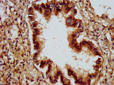 ALG9 Antibody - IHC image of ALG9 Antibody diluted at 1:300 and staining in paraffin-embedded human lung tissue performed on a Leica BondTM system. After dewaxing and hydration, antigen retrieval was mediated by high pressure in a citrate buffer (pH 6.0). Section was blocked with 10% normal goat serum 30min at RT. Then primary antibody (1% BSA) was incubated at 4°C overnight. The primary is detected by a biotinylated secondary antibody and visualized using an HRP conjugated SP system.