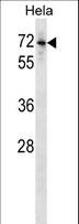 ALK-6 / BMPR1B Antibody - Mouse Bmpr1b Antibody western blot of HeLa cell line lysates (35 ug/lane). The Bmpr1b antibody detected the Bmpr1b protein (arrow).