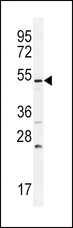 ALK-6 / BMPR1B Antibody - BMPR1B Antibody western blot of U251 cell line lysates (35 ug/lane). The BMPR1B antibody detected the BMPR1B protein (arrow).